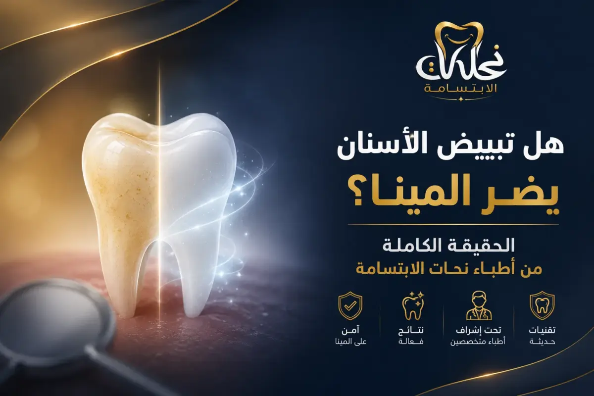 هل تبييض الأسنان يضر المينا؟ الحقيقة الكاملة من أطباء نحات الابتسامة