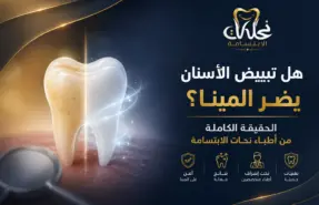 هل تبييض الأسنان يضر المينا؟ الحقيقة الكاملة من أطباء نحات الابتسامة