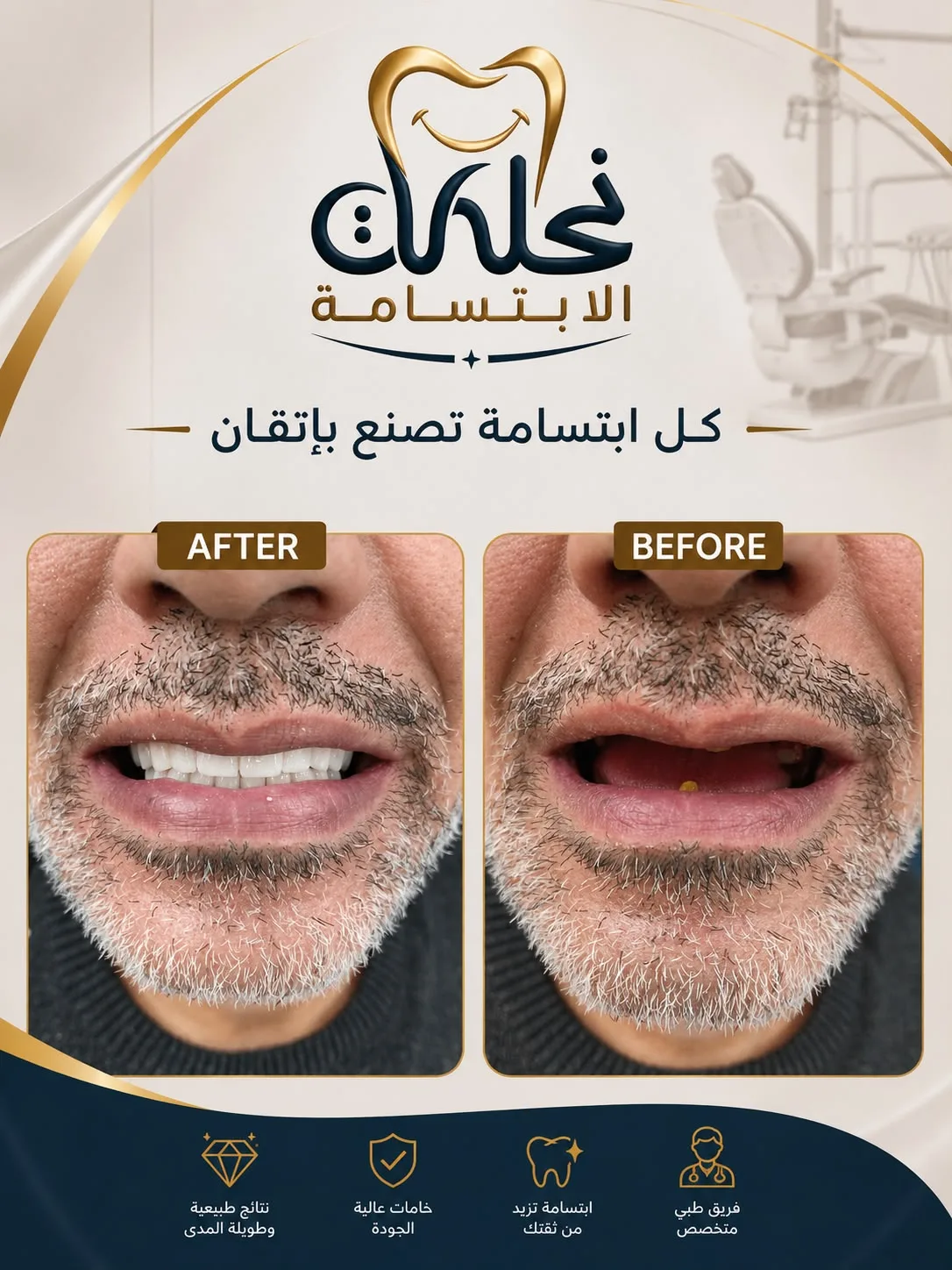 قبل وبعد تجميل الأسنان باستخدام ابتسامة هوليود في نحات الابتسامة