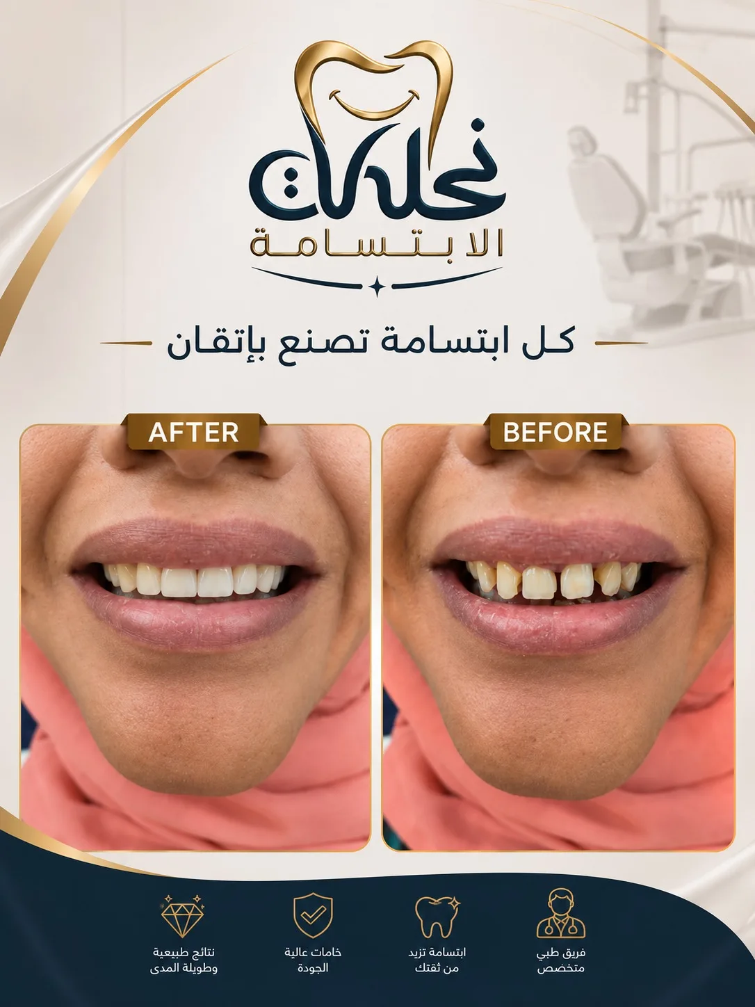 قبل وبعد ابتسامة هوليود مع تعويض الأسنان المفقودة بنتائج طبيعية في نحات الابتسامة
