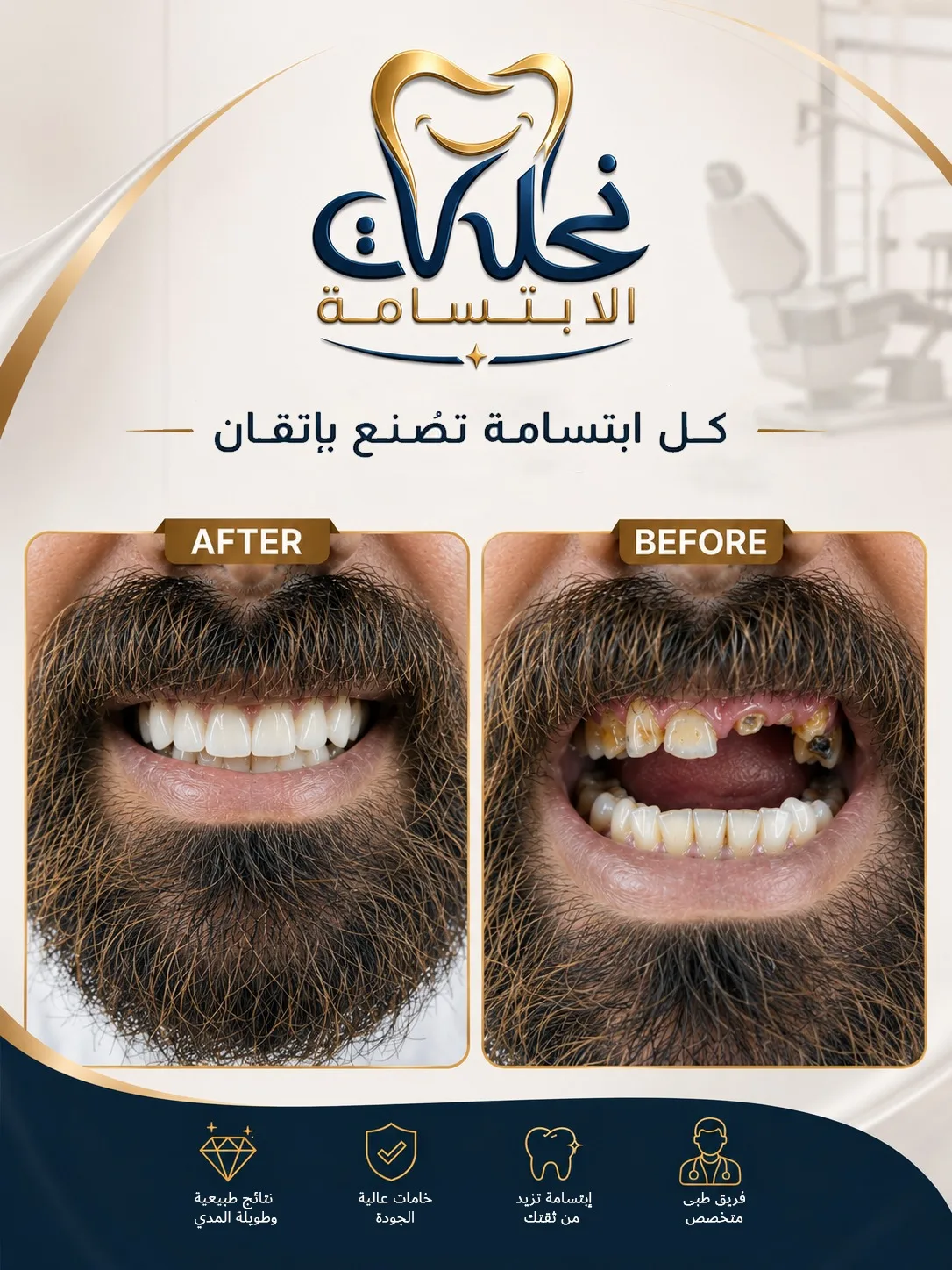 نتائج قبل وبعد ابتسامة هوليود لتصحيح شكل الأسنان في نحات الابتسامة