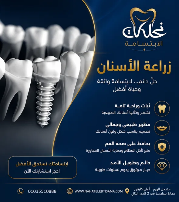 زراعة الأسنان في نحات الابتسامة باستخدام أحدث التقنيات لتعويض الأسنان المفقودة بنتائج طبيعية