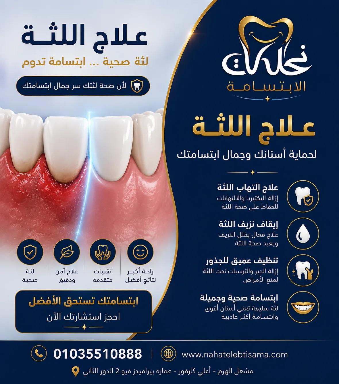 علاج اللثة في نحات الابتسامة للتخلص من الالتهابات والحفاظ على صحة الفم.
