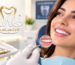 ابتسامة هوليود في مصر